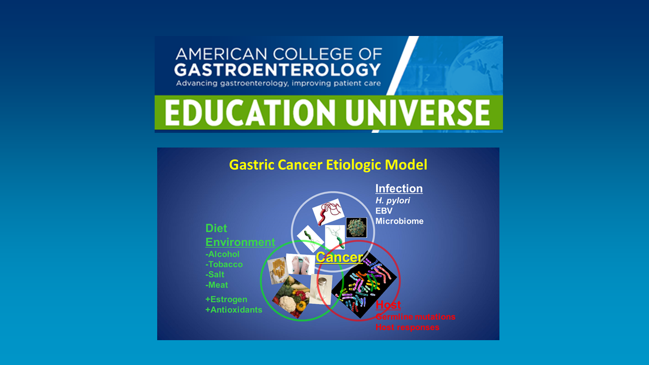 Gastric Cancer Etiologic Model Graphic